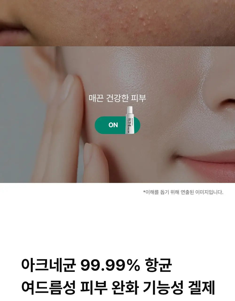 [단독기획] 동아제약 아크네 프로 겔제 30ml 기획(+3ml+크림제3ml) 상세페이지 9